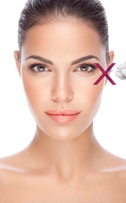 Removing Eye Bags With Surgery And Without Surgery Please Visit