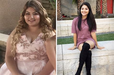 Obese Teen Lost 7 And A Half Stone In A Year By Ditching