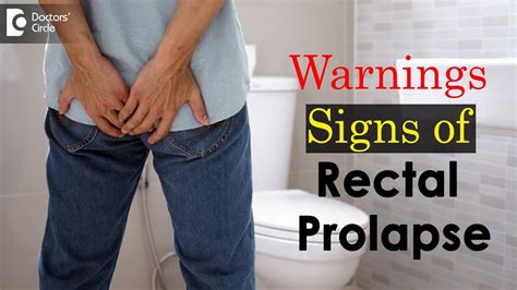 signs and symptoms of rectal prolapse dr rajasekhar m r youtube