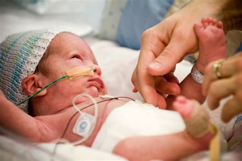 premature babies facts  trivia