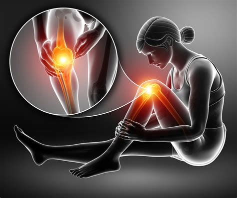 bol  kolenu moze da se otkloni uz  efikasnih vezbi za podrsku ovom zglobu eklinika