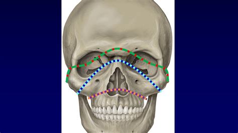facial fractures 1 youtube in 2020 human anatomy and