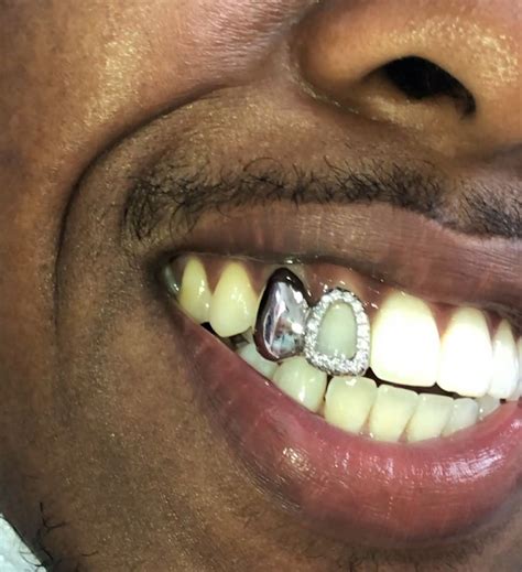 real gold grillz   custom gold grillz buy gold teeth