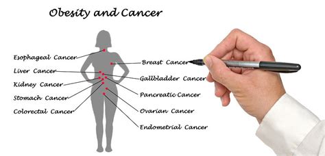 The Connection Between Obesity And Cancer