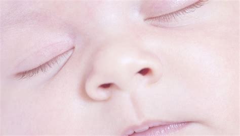 newborns  abnormal development   adult