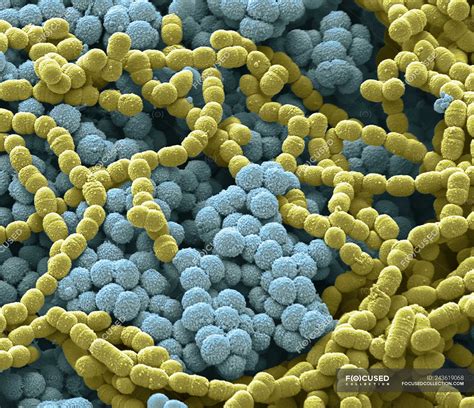scanning electron micrograph  bacterial culture  sputum