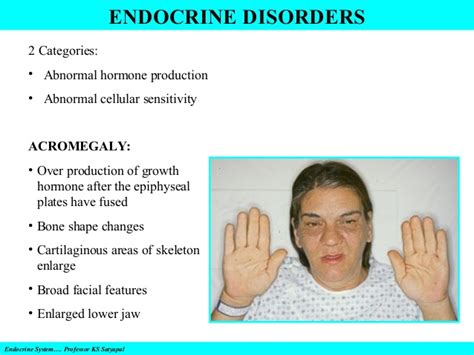 endocrine system and disorders gland by gland