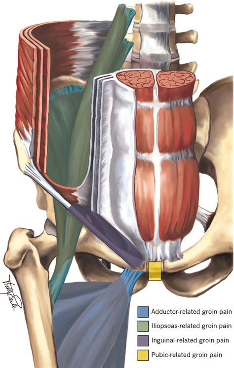 Groin Pain In Athletes Symptoms Causes And Treatment