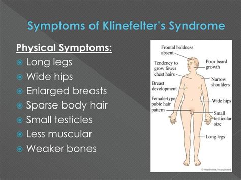 Klinefelters Disease Definition – Qqmcuo