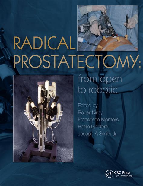 Radical Prostatectomy From Open To Robotic 1st Edition Hardback