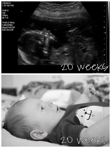 20 week comparison 20 weeks ultrasound picture in the belly and 20 weeks in the outside world