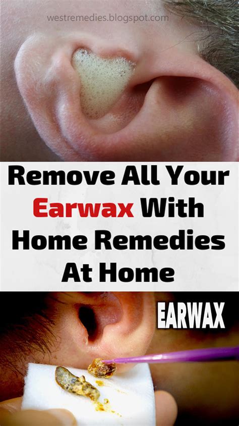 remove   earwax  home remedies  home    images