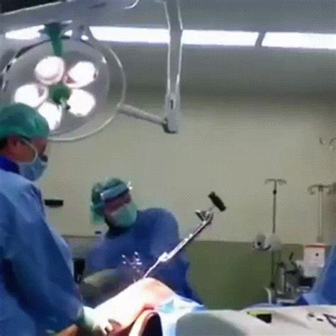knee surgery it s a delicate operation on imgur funny