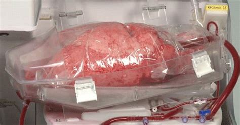 how a human donor lung is kept alive before a transplant huffpost uk