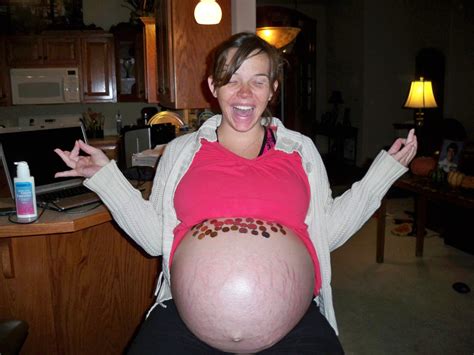 Triplet Pregnancy Triplets Pregnancy Pregnant Belly Belly Bump