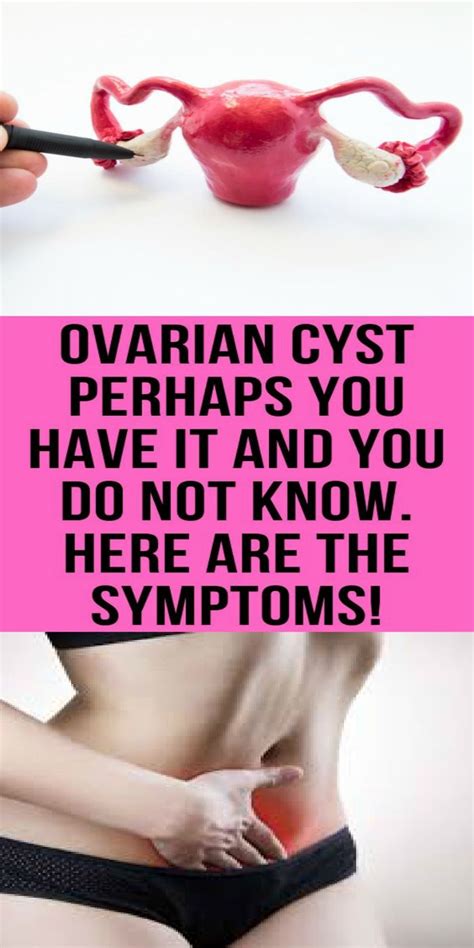 ovarian cyst perhaps you have it and you do not know here are the