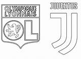 Champions League Juventus Coloriage Ligue Uefa Olympique Juve Lyonnais Coloriages Bonjourlesenfants Turin Escudo Morningkids Imprimer Maillot 2031 sketch template