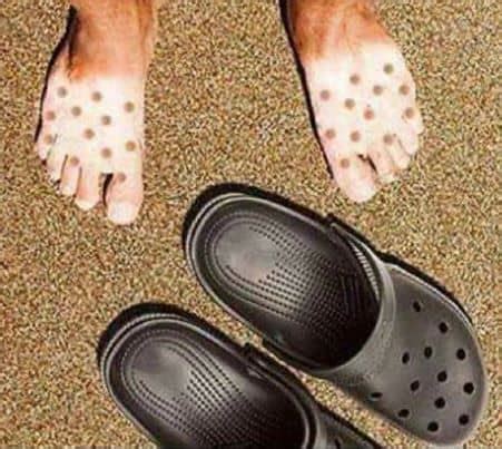 crocs   bad   feet awesomejellycom