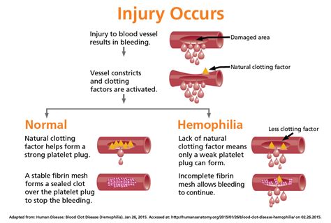 symptoms and effects hemophilia 2nd period