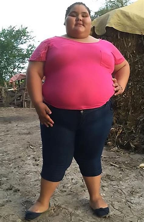 Fattest Teenager In World Sheds 14st – See Her Amazing Transformation