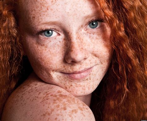 how i grew to love my freckles with images redheads freckles