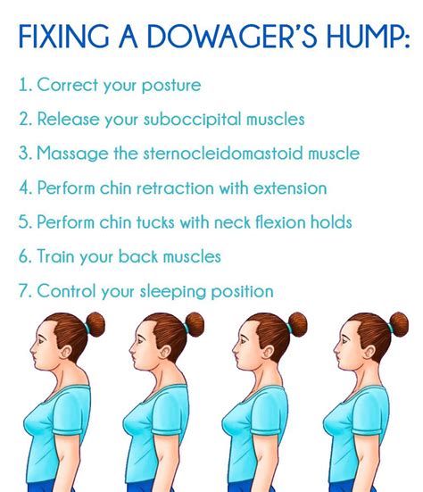 posture correction exercises dowagers hump neck exercises