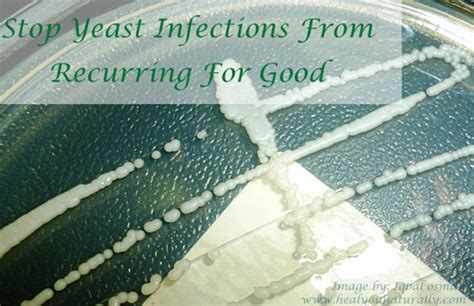 The Best Kept Secret To Cure Yeast Infections For Good And