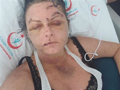 tourist bashed after refusing sex at turkish holiday