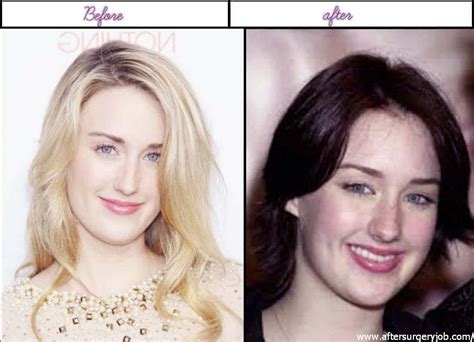 pin by patric on unmask the celebs ashley johnson plastic surgery pictures plastic surgery