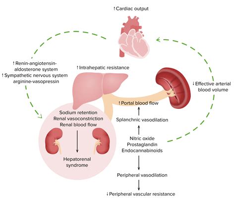Síndrome Hepatorrenal Concise Medical Knowledge