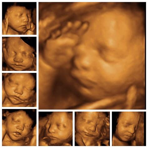 cherished memories dd ultrasound   ultrasound imaging