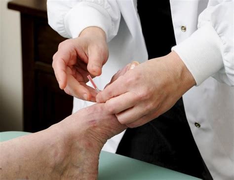 What Are The Acupuncture Points For Plantar Fasciitis