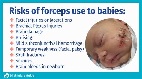 forceps linked  birth injuries birth injury guide