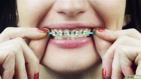 How To Make Fake Braces 11 Steps With Pictures Fake Braces Diy