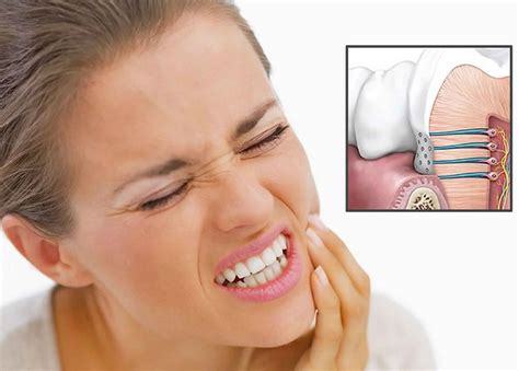 teeth sensitivity definition  diagnosis treatment