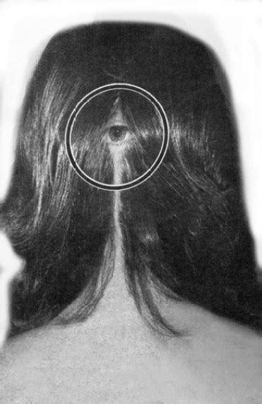Florida Woman Has 3rd Eye In The Back Of Her Head