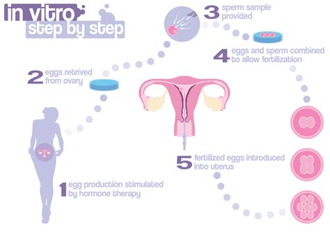 vitro fertilization ivf  plain english chuba oyolus portfolio