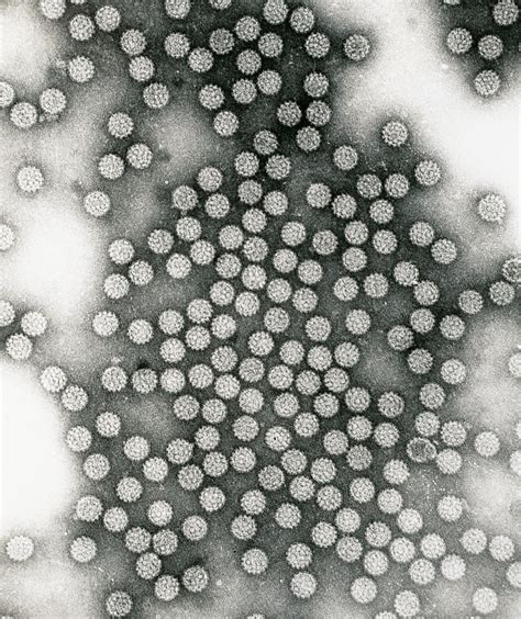 close    american adults infected  hpv survey finds