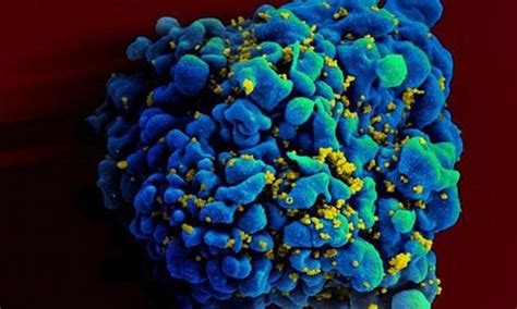 Woman Gives Her Lesbian Partner Hiv In Extremely Rare Case Of Female To
