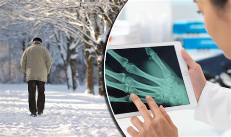 Arthritis Pain Does Cold Weather Make Symptoms Worse