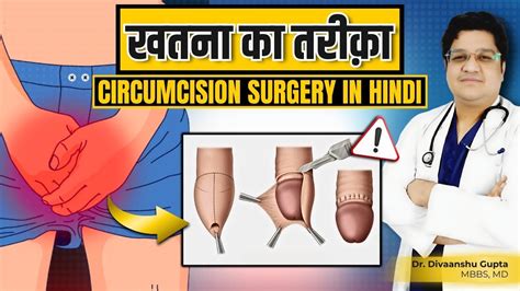 Circumcision Operation खतना कैसे किया जाता है Circumcision Myths