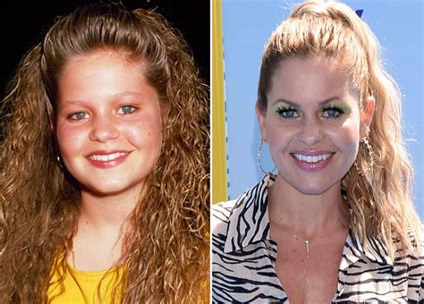 Candace Cameron Plastic Surgery With Before And After Photos