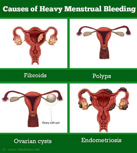 menstrual periods print