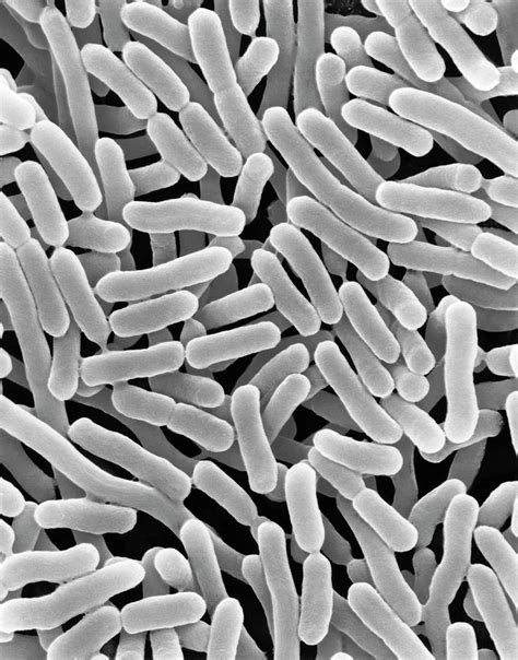 bakteria salmonella enterica serovar weltevreden sah punca keracunan