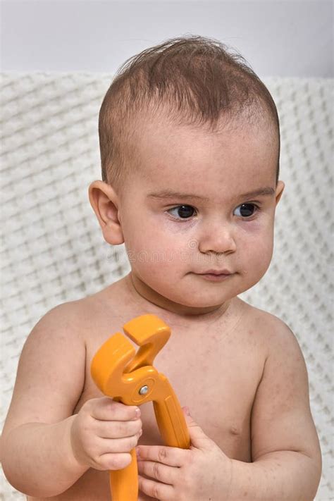 roseola utslag ett viralt utslag pa huden hos ett barn fotografering foer bildbyraer bild av