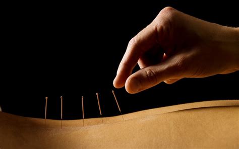 5 benefits of acupuncture back to wellness