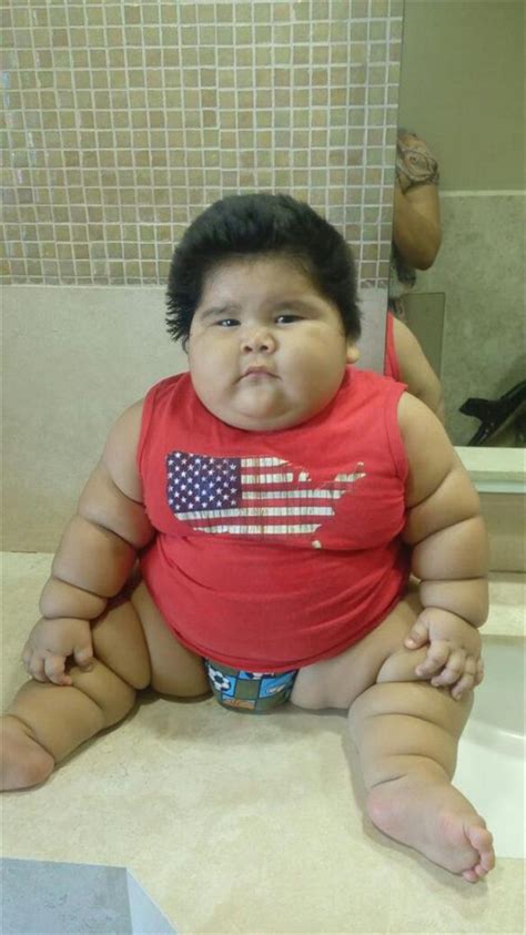 Bebé Mexicano De Diez Meses Pesa 28 Kilos Por Deficiencia