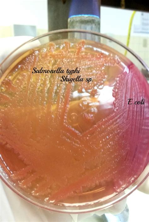 salmonella typhi gram stain morphology schlagzeilen sa