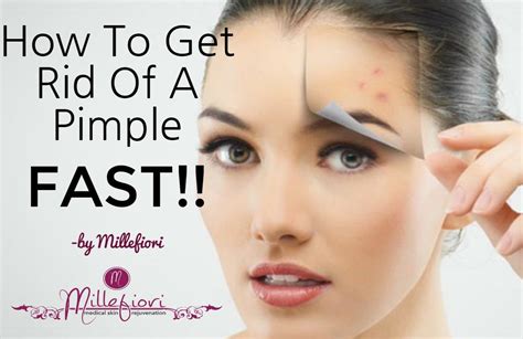 top  ways  erase  pimple today millefiori medical skin
