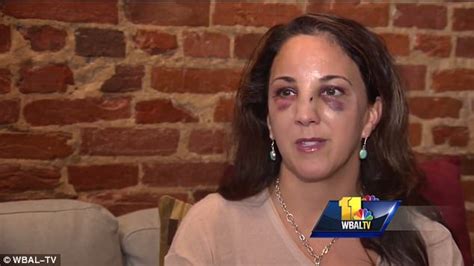 baltimore woman attacked by ten teens on halloween daily